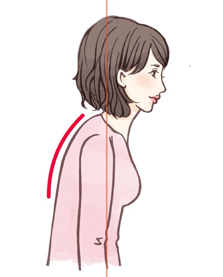 円背型猫背姿勢