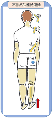 不自然な連動運動